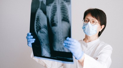 Woman wearing mask holding x-ray